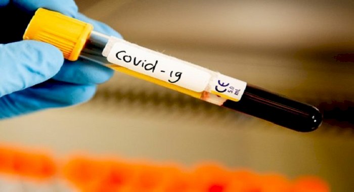 Cât de rezistent va fi noul coronavirus în timpul verii. Temperatura care-l poate eradica în mai puţin de 5 minute